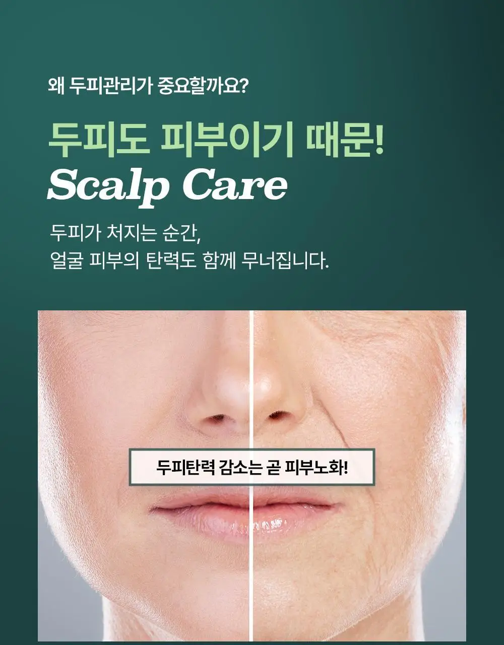 [올영1위 두피앰플] 민트리 스칼프 세럼 20ml 상세페이지 9